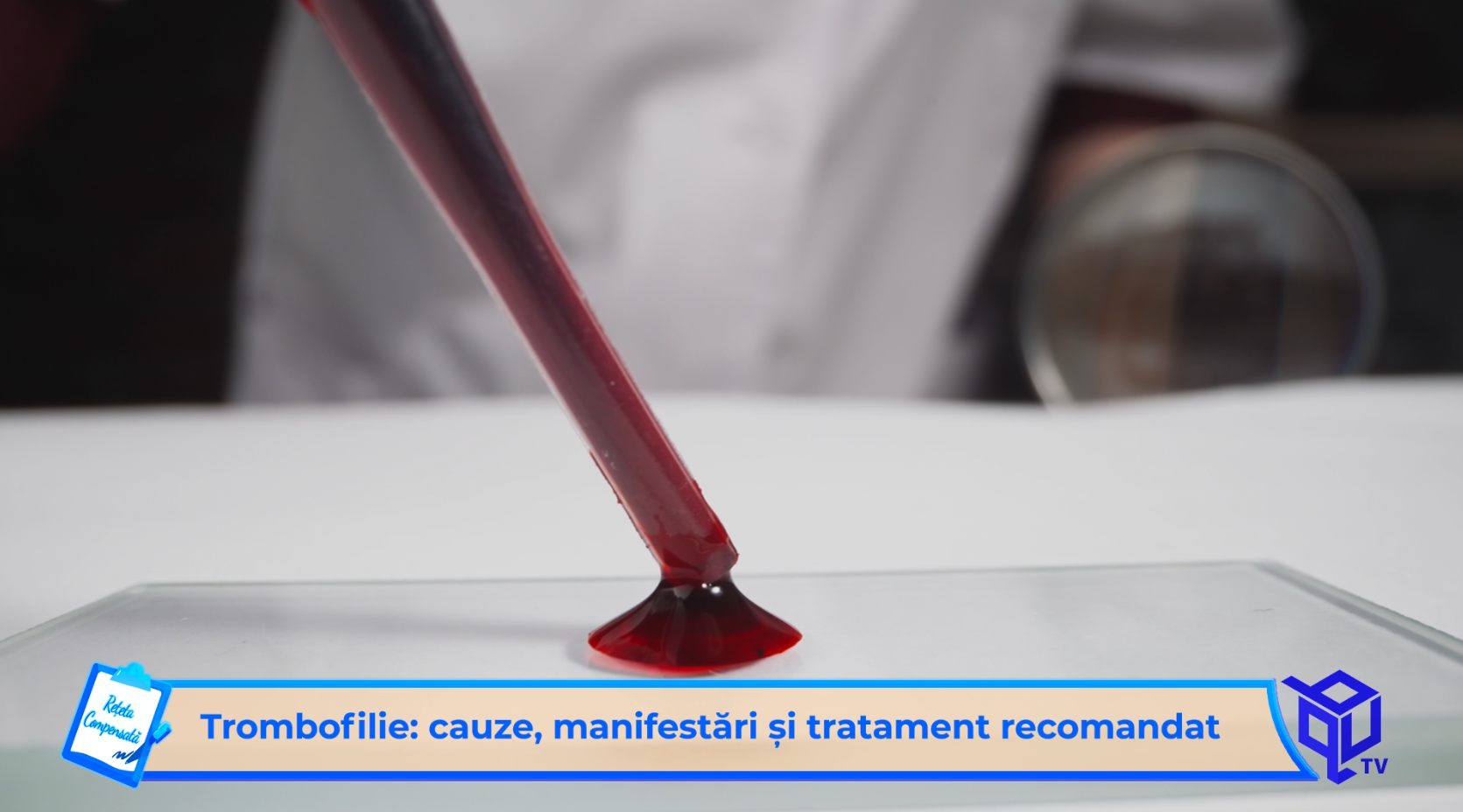 Trombofilie: cauze, manifestari si tratament recomandat - Rețeta ...